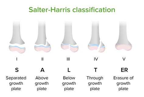Deslizamiento Epifisario de la Cabeza Femoral | Concise Medical Knowledge