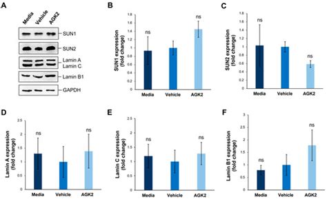 SIRT2 Inhibition by AGK2 Promotes Perinuclear Cytoskeletal Organisation ...