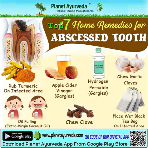 The Best Tooth Abscess Homeopathic Treatment Ideas