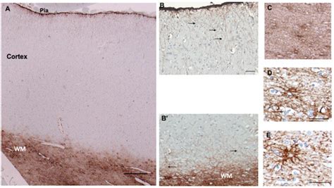 Cells | Special Issue : Astrocytes in CNS Disorders