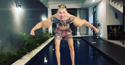 Russian Popeye Admits Injections Caused Unfixable Damage