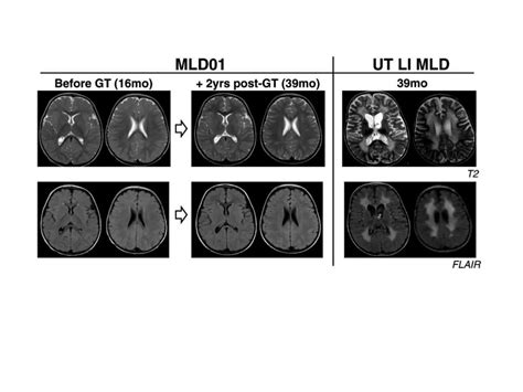 Approach to white matter disease | PPTX