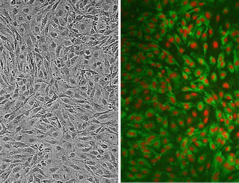 Human Carotid Artery Endothelial Cells: HCtAEC | Life Technologies ...