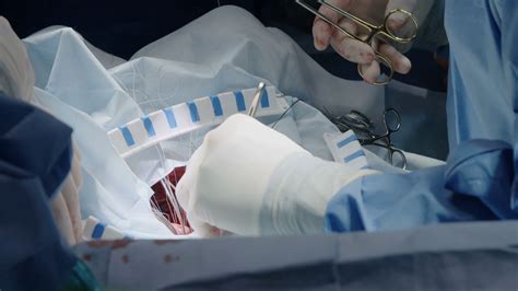 open heart surgery: risks of open heart surgery – YOFNV