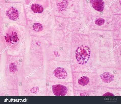 101 Profase Huso Images, Stock Photos & Vectors | Shutterstock