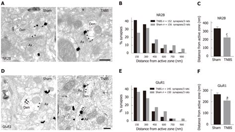 Nucleus tractus solitarius mediates hyperalgesia induced by chronic pancreatitis in rats