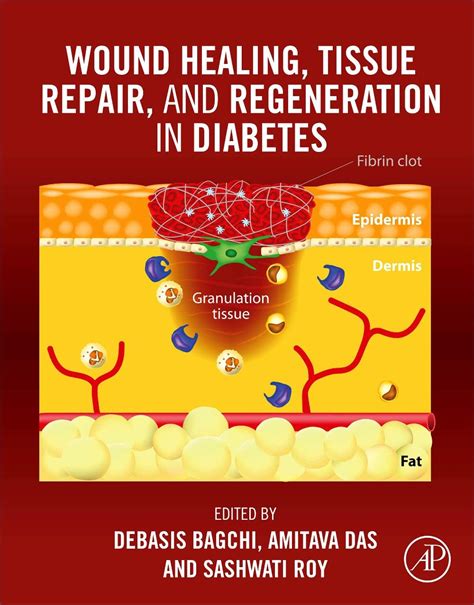 Buy Wound Healing, Tissue Repair, and Regeneration in Diabetes Book ...