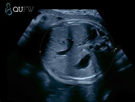 Obstetrician What Is