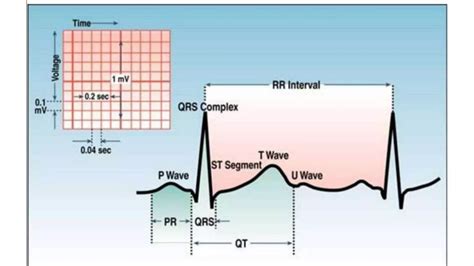 Basic ECG Rhythms 的图像结果