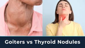 Image result for Thyroid Function Algorithm