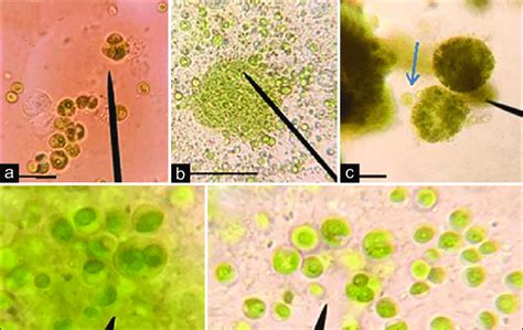 Image result for Reproduction of Chlorella