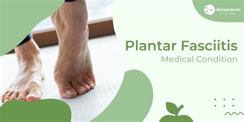 Chiropractic Treatment for Plantar Fasciitis Pain Relief
