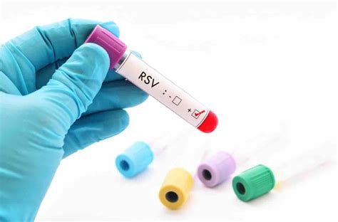 Respiratory Syncytial Virus (RSV) Symptoms in Adults and Young Children | USA Health Articles