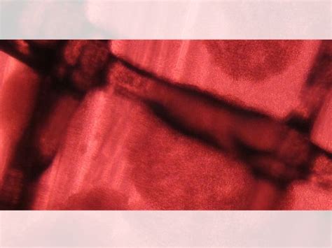 Cell therapy options at Guang-Li Biomedicine and Taipei Medical ...