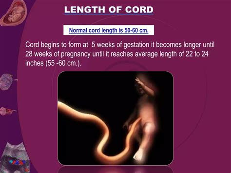 Length Of Umbilical Cord
