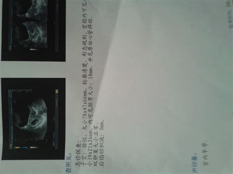 怀孕65天胎儿彩超图,怀孕9周胎儿真实图 - 伤感说说吧