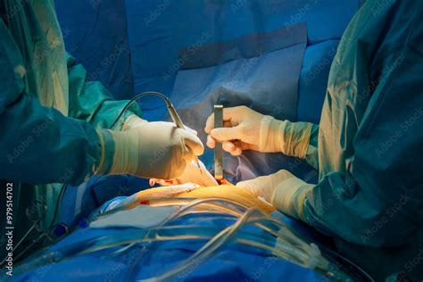 Image result for Operating Room Procedures Patient