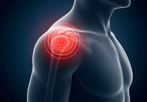 Shoulder pain indicated on human anatomy with red highlight | Premium ...