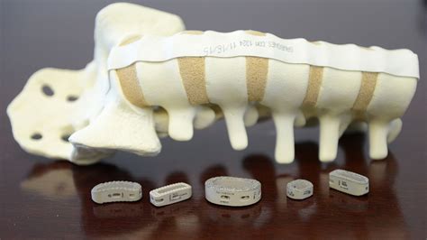 Tyber Medical receives US FDA clearance on foot and ankle plating systems