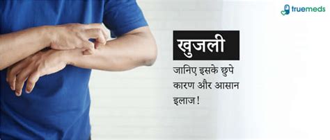 Kenacort New 0.1% Paste: Uses, Side Effects, Price & Substitutes