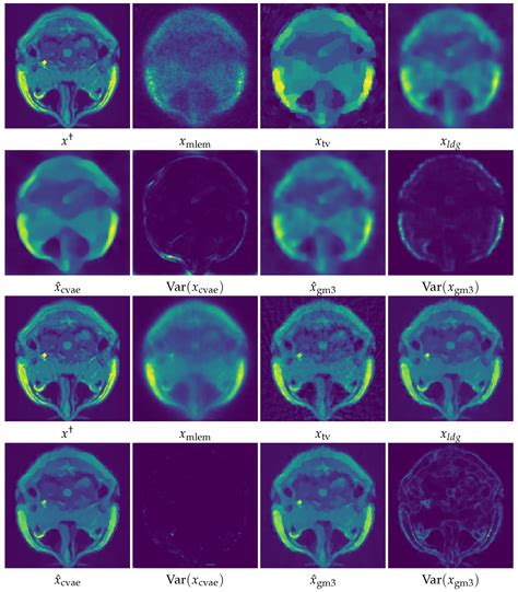 Conditional Variational Autoencoder for Learned Image Reconstruction