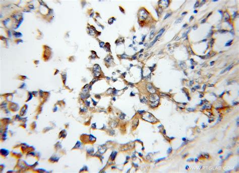 Arylsulfatase D antibody (11805-1-AP) | Proteintech
