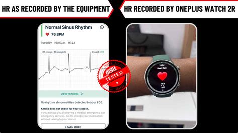 OnePlus Watch 2R First Impressions: How well does it track your vitals?