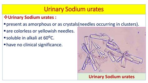 Microscopic examination of urine | PDF