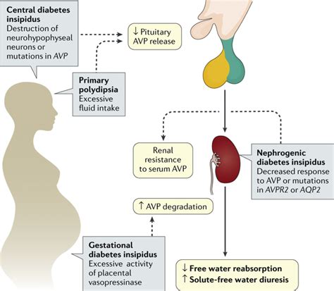 Diabetes Insipidus - Endocrinology and Metabolism Clinics