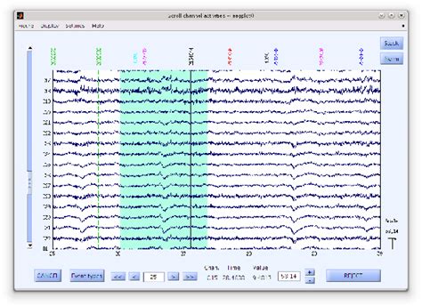 Image result for EEG MATLAB Load File