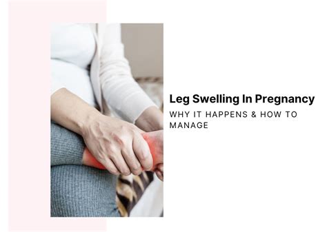 How to Reduce Swelling in Legs During Pregnancy? – House Of Zelena™