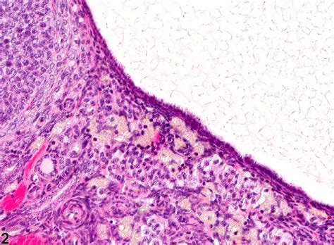 Ovary, Follicle - Cyst - Nonneoplastic Lesion Atlas