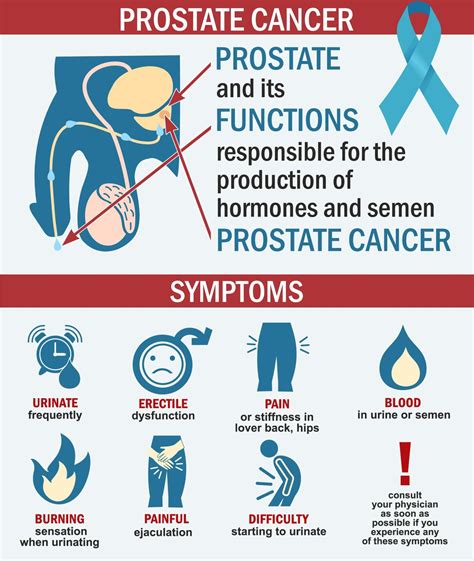 Prostate Cancer Symptoms Pain Is Back And Hip Pain A Symptom Of