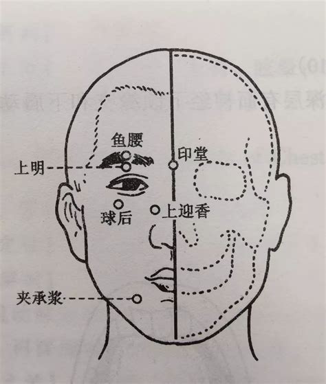 眼眶骨折系列之二：眼眶内侧壁骨折的手术前后 - 微医（挂号网）