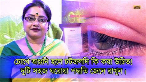চোখের পাতায় অঞ্জনি হলে কি করবেন? জেনে নিন দুটি সহজ ঘরোয়া টোটকা ...