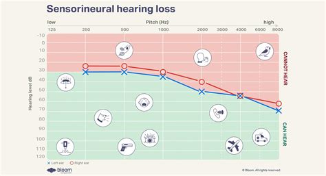 How to read an audiogram: Essential types and symbols