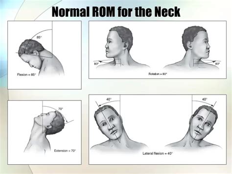 Image result for Cervical Rotation Exercise Drawing