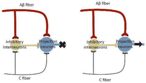 Neural Circuitry Polarization in the Spinal Dorsal Horn (SDH): A Novel ...