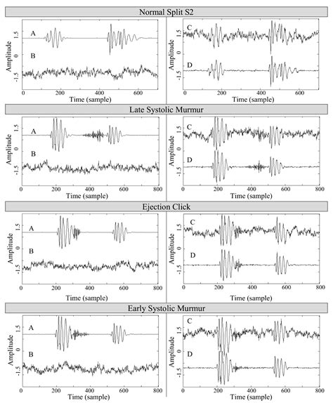 A Wavelet Transform-Based Neural Network Denoising Algorithm for Mobile ...