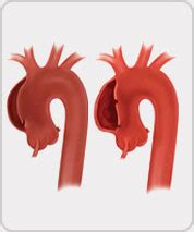 Best Vascular Surgeon In Delhi NCR | Dr Rajiv Parakh