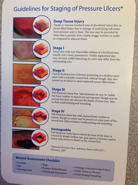 Stage 2 Bed Sore , What Are Bed Sores (Pressure Ulcers)? – EHTN