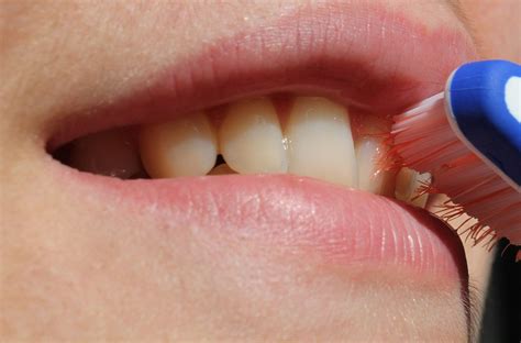 Image result for Teeth Staining Causes
