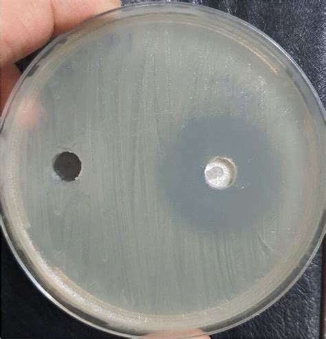 Image result for Agar Plug Diffusion Method