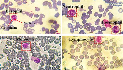 Image result for Lymphocytes Microscopic View