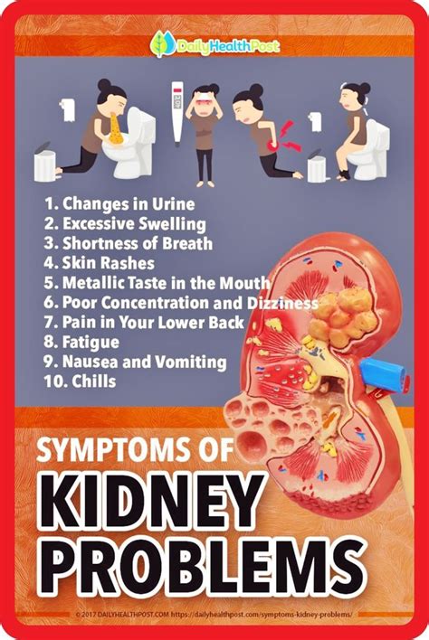 lupus kidney pain