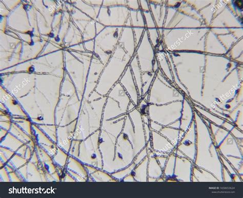 Mushroom Cell Under Microscope