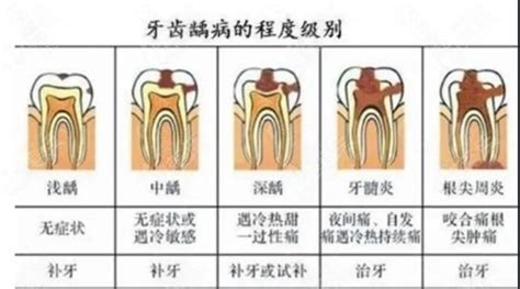 在深圳做一个活动假牙多少钱-爱康健齿科