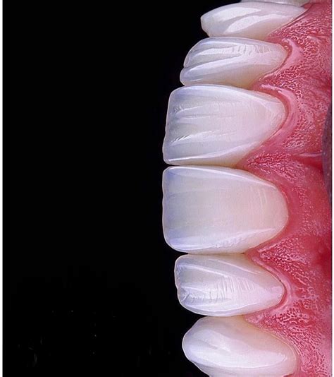 Beautiful teeth | Dental aesthetics, Dental anatomy, Beautiful teeth