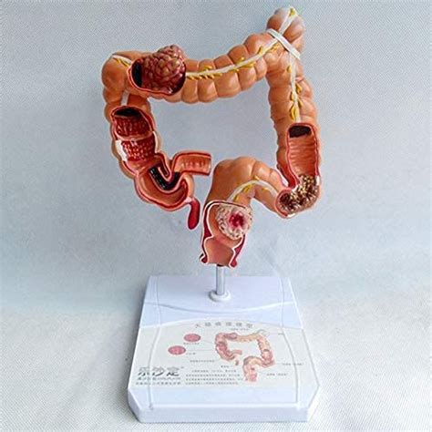 Buy QHYXT Study Model Anatomy Models, Colon Model, Human Colon Large ...