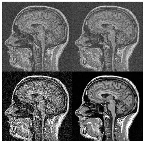 Inverse Multiscale Discrete Radon Transform by Filtered Backprojection